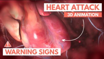 Recognizing a Heart Attack
